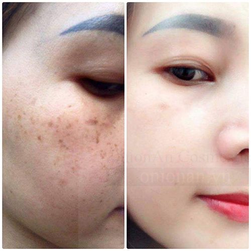 Sữa Rửa Mặt Chiết Xuất Từ Trà Xanh 3W Clinic Green Tea Cleansing Foam